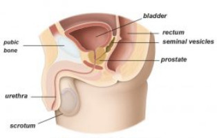 Εικ. 2: Καλοήθης Υπερπλασία τουΠροστάτη Image